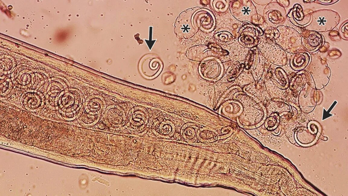 The Ocular Invaders: Unpacking the Complex Life Cycle of Thelazia callipaeda